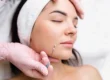 PDO Thread Lift in Moscow, id at Ageless Aesthetics